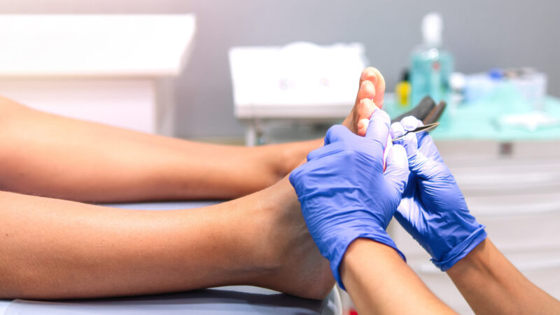 Podiatrist doing chiropody in her podiatry clinic. Selective focus